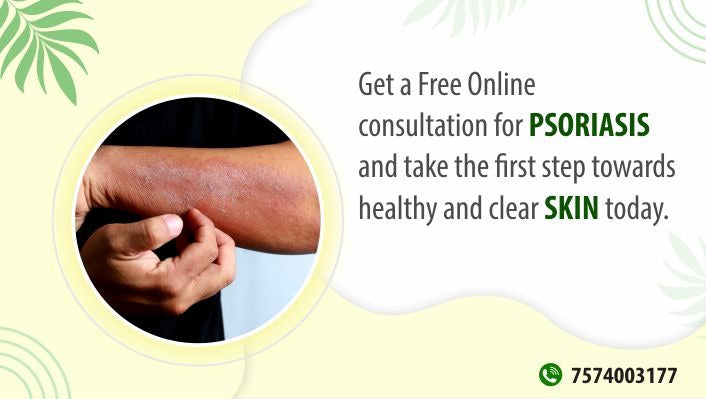 Free Online Consultation for Psoriasis: Get the Help You Need Today