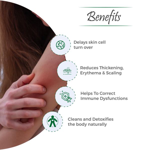 Bactimo-Psor Capsules - Ayurvedic Solution for Psoriasis